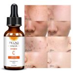 MELAO-Vitamin-C-Facial-Serum-Anti-Aging-Whitening-Brightening-Dark-Spots-Freckle-Remove-Hyaluronic-Acid-Vitamin
