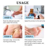 Wart-Removal-Essential-Oil-Painless-Remover-Skin-Tags-Treatment-Body-Flat-Wart-Genitals-Repair-Black-Spot